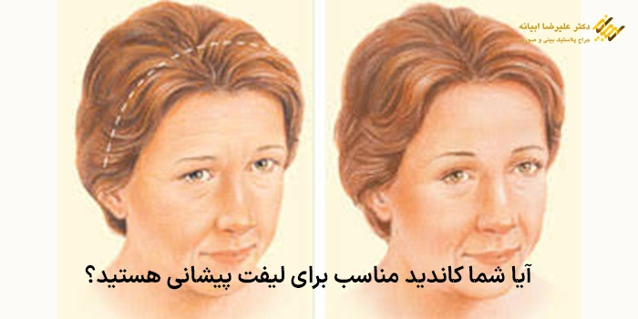 آیا شما کاندید مناسب برای لیفت پیشانی هستید؟