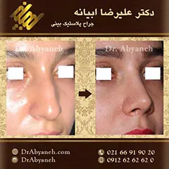 نمونه کار دکتر علیرضا ابیانه