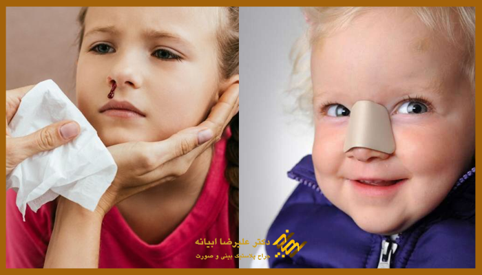 عکس دماغ شکسته بچه