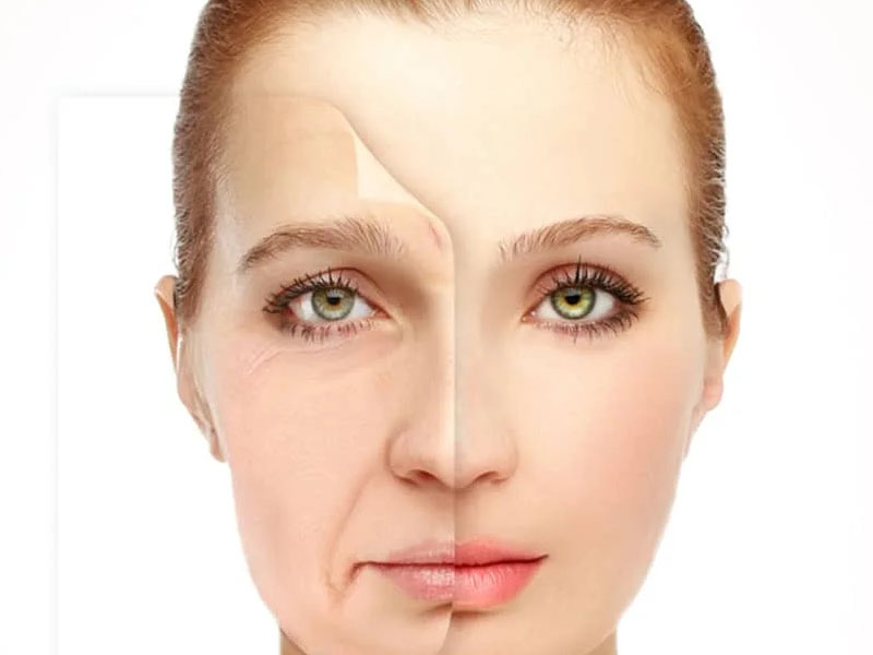 بهترین روش لیفت صورت - دکتر علیرضا ابیانه