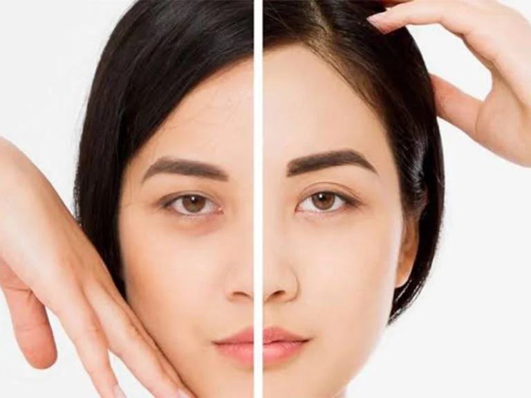 بهترین دکتر جراحی لیفت شقیقه