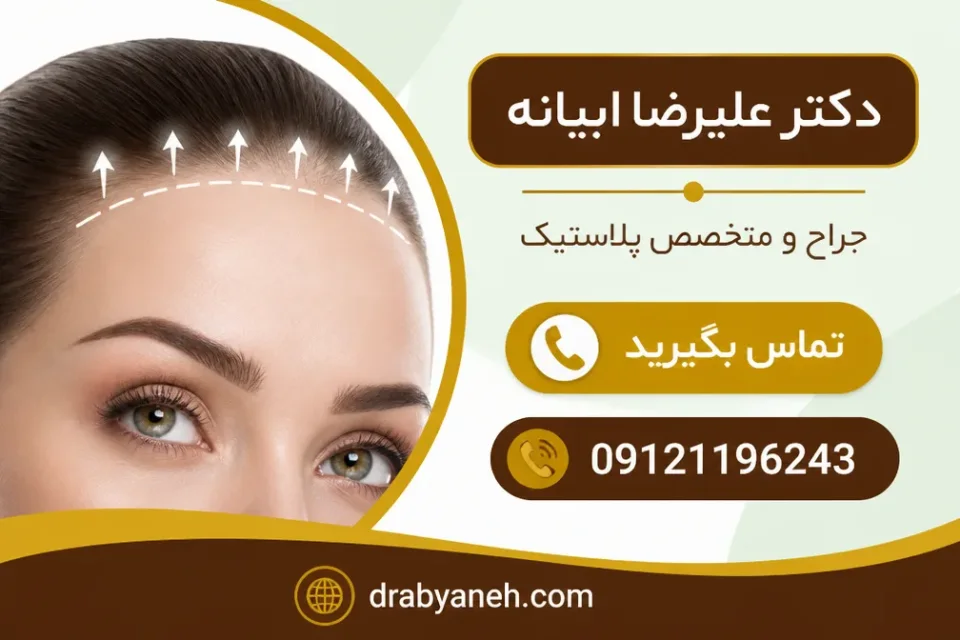 نمای توضیحی درباره لیفت ابرو از خط رویش مو